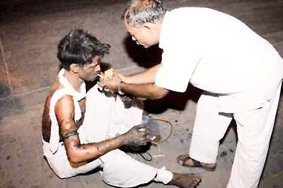 Burnt rooftop traveller flees hospital, lights up