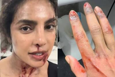 Priyanka Chopra Shares Clip Of Injured Hand But It Is For Her Upcoming Film The Bluff