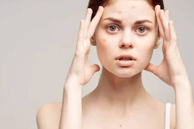 Exposure to Pollution Can Have Serious Effects On Our Skin, Here Are Some Tips To Prevent It