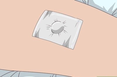 How to Remove Warts Naturally