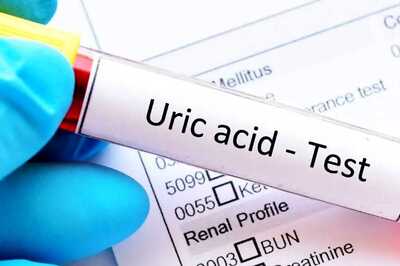 Almonds To Cashews: 5 Dry Fruits That Can Help Lower Uric Acid Levels