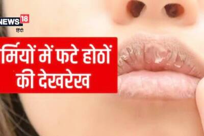 Home Remedies on How To Heal Chapped Lips