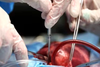 Mumbai Doctors Perform C-Section Under Torchlight, Deliver Dead Boy; Mother Passes Away Hours Later