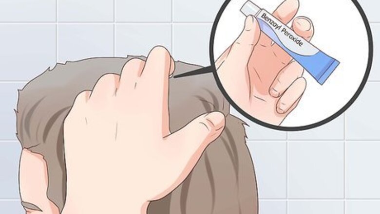 How to Treat Scalp Pimples