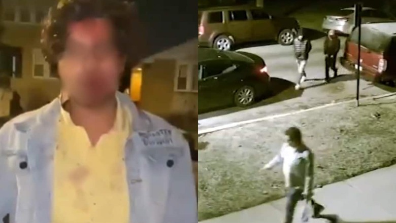 'Please Help': Brutal Attack On Hyderabad Student In US Captured On CCTV, Indian Mission Steps In
