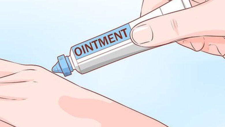 How to Treat Severe Plaque Psoriasis