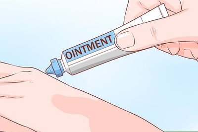 How to Treat Severe Plaque Psoriasis