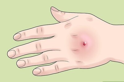 How to Test for MRSA