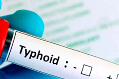 Typhoid-Causing Bacteria Resistant to Key Antibiotics, Including Azithromycin: Lancet Study