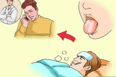 How to Get Rid of White Tongue