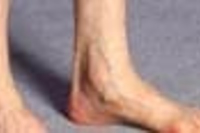 Since teenage, nude jogs gave this man a high