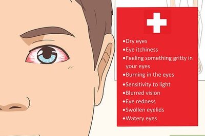 How to Treat Ocular Rosacea