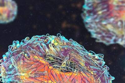 World Zoonosis Day 2022: What is Zoonosis and How Does Such Infectious Disease Spread?