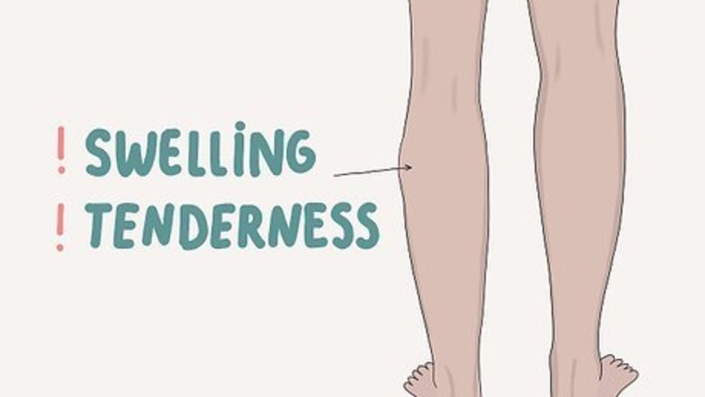 How to Diagnose and Treat Thrombophilia