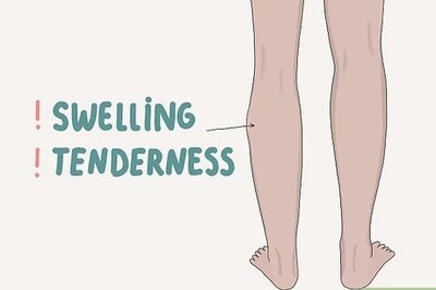 How to Diagnose and Treat Thrombophilia