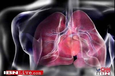 TN government urged to cover heart transplants in insurance