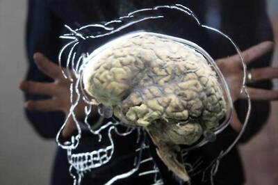 Bad Gut Bacteria Linked to Multiple Sclerosis