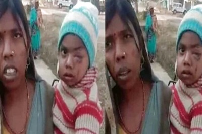 In MP’s Sidhi, Mother Chases Leopard, Saves Her 6-Year-Old Son