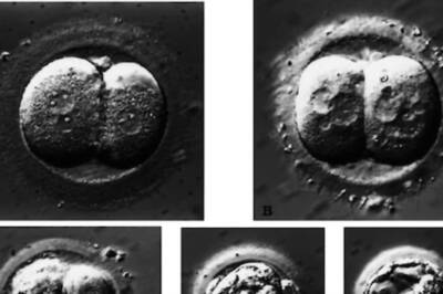 A US Court Ruled That Frozen Embryos Are People, What Does It Mean for the Future of IVF?