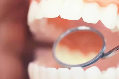 8 Home Remedies to Naturally Get Rid of Tooth Cavity