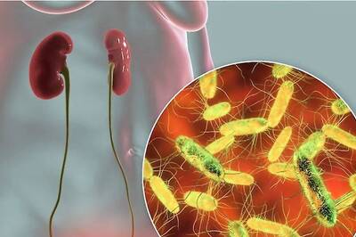 7 Healthy Habits To Take Care Of Your Urinary Bladder
