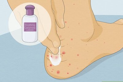 Sand Flea Bites: Treatment, Prevention, & More