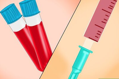 How to Treat Dissociative Fugue