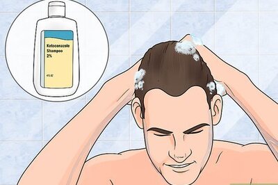 How to Treat Male Pattern Hair Loss
