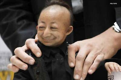 World's smallest man dies of heart attack at 21