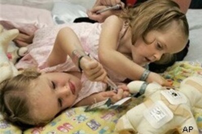 Conjoined twins prepare for surgery