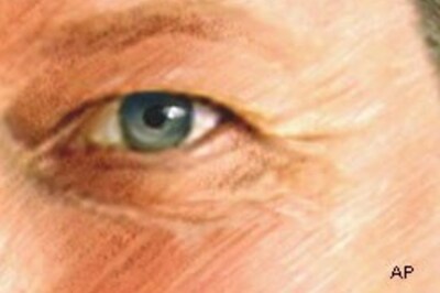 Russians open to cosmetic surgery: survey