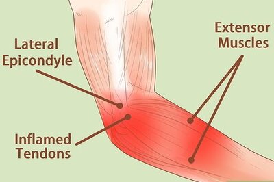 How to Heal a Sore Arm