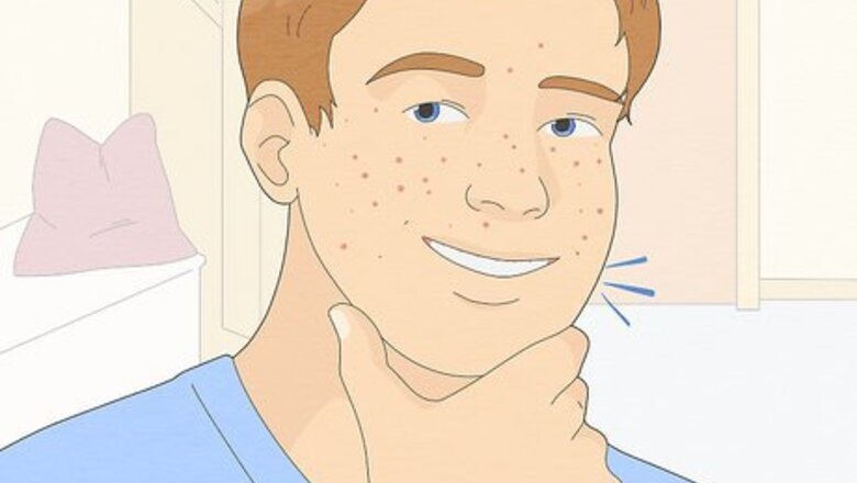 How to Be Confident If You Have Acne
