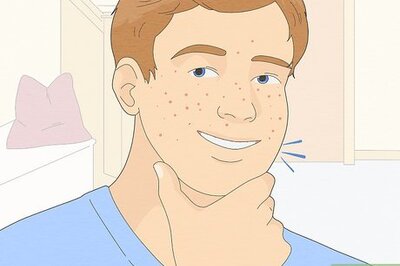 How to Be Confident If You Have Acne