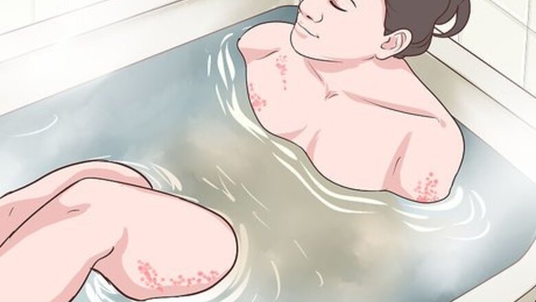 How to Soothe Psoriasis Itching