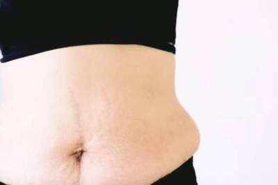 BuzzFix: Women's Day is More Than Just a 'Celebration', It's About 'Knowing' Them First