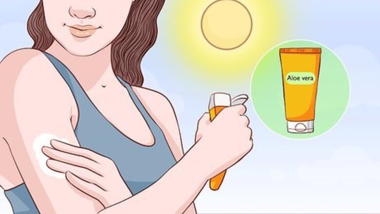 How to Treat Sunburn with Natural Remedies