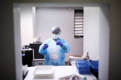 Covid-19 Antibodies Last at Least Three Months; So Do Symptoms For Many