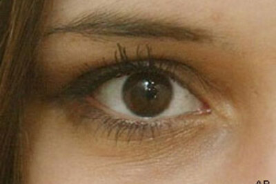 Eyes reveal the status of your health