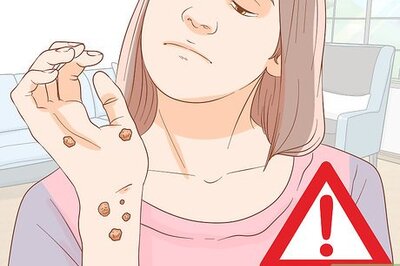 How to Test for HPV