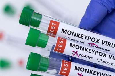 Lab Result Negative for Suspected Monkeypox Case in Noida