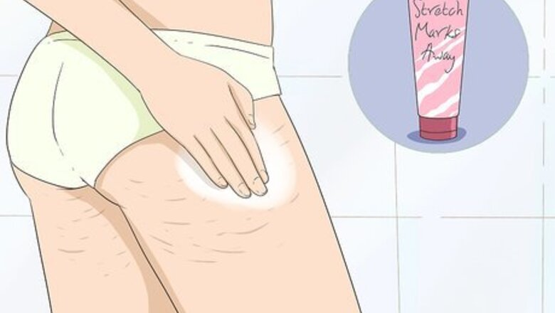 How to Get Rid of Stretch Marks at Home