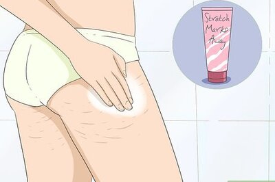 How to Get Rid of Stretch Marks at Home
