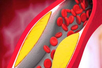 Skin Rashes To Yellow Spots Around Eyes, High Cholesterol Signs Not To Be Ignored