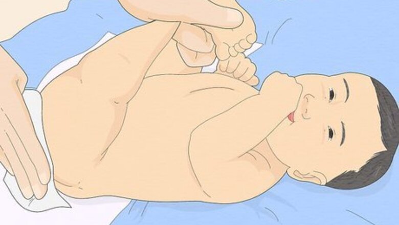 How to Treat Diaper Rash