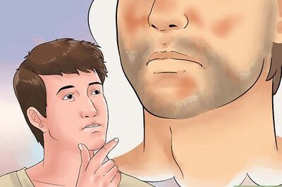 How to Treat Seborrheic Dermatitis on Your Face