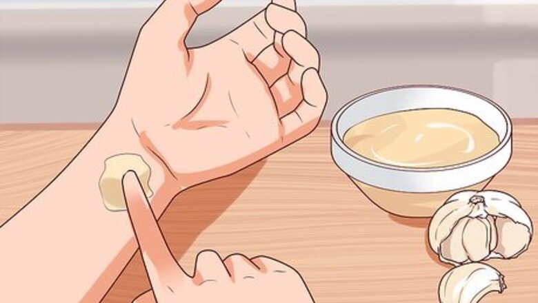 How to Remove Warts Naturally Using Garlic