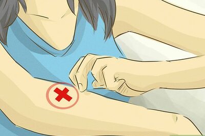 How to Stop Scratching a Mosquito Bite